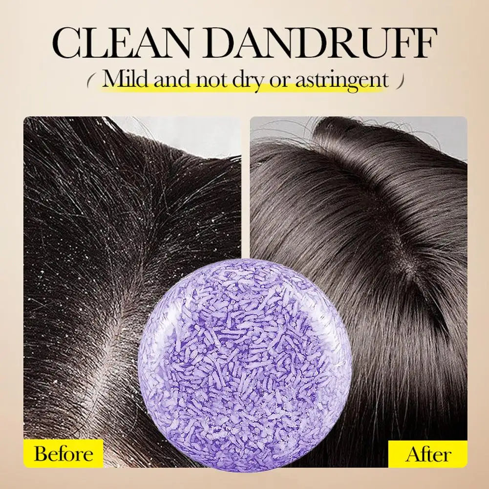 Haarseife Lavendel – gegen fettiges Haar & Schuppen